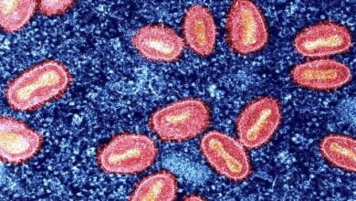 "جدري القردة".. حالة طوارئ صحية عالمية ولقاحات محدودة الكمية