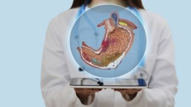 أطعمة تسبب قرحة المعدة